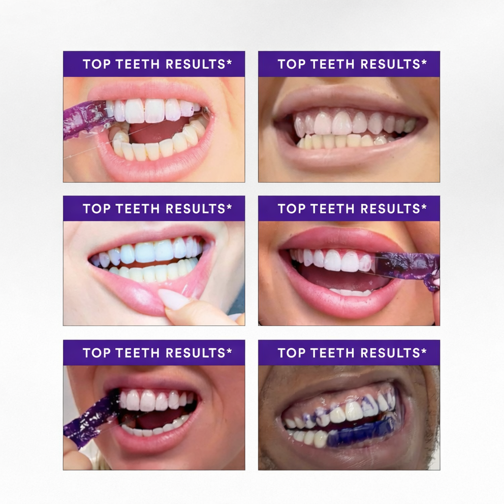 Purple Teeth Whitening 7 Strips